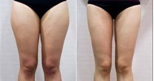 浙江杭州有沒有靠譜的鵬愛整形醫(yī)院？頂尖專家現(xiàn)身說法！