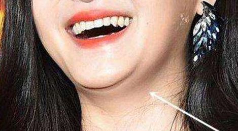 恩施州中心醫(yī)院整形外科療效如何？專家解析+服務費用披露