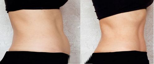 重慶頂級(jí)植發(fā)醫(yī)院排名：重醫(yī)大附一院和雍禾技術(shù)領(lǐng)先！