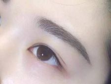 李炳澮醫(yī)生獨(dú)特的技術(shù) 手術(shù)風(fēng)格有何特點(diǎn)？并附帶隆鼻案例分析