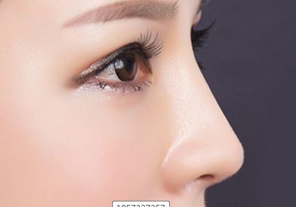 李天石磨骨費(fèi)用公示與患者見證，現(xiàn)網(wǎng)友分享醫(yī)師簡介！