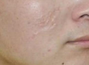 上海雙孖醫(yī)療美容門診部的醫(yī)生技術(shù)和口碑如何？為什么選擇他們？