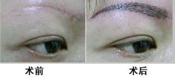 廣州哪家醫(yī)院靠譜？私立醫(yī)美口碑排行榜來襲！