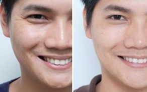 選擇正規(guī)的西安整形醫(yī)院，這些排行名單都推薦！