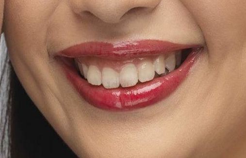 2023年北京近視手術高手引領潮流，瞿長斌、林順潮、熊瑛等五位專家資料公開！