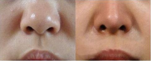 上海哪家醫(yī)院進(jìn)行拉皮手術(shù)的技術(shù)和聲譽(yù)最出色？