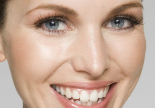 上海清沁董雷的雙眼皮修復(fù)方案親身體驗案例詳解