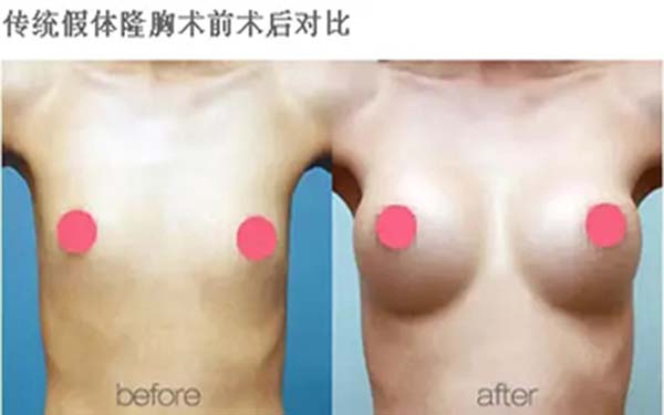 首選，你想知道成都素美脂肪填充的表現(xiàn)如何？！其次，成都素美脂肪填充的效果如何呢？