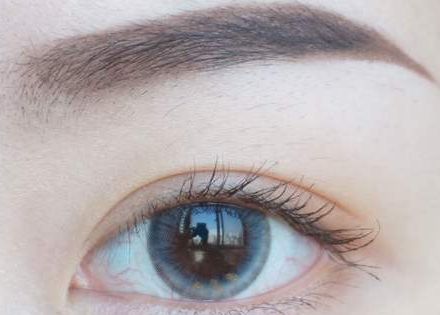 寧波楊加峰做雙眼皮：專業(yè)醫(yī)生技術(shù)與成功案例揭秘