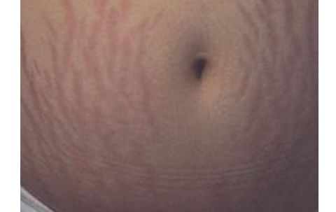 南昌佳美整形醫(yī)院：醫(yī)生團(tuán)隊強(qiáng)大，雙眼皮案例獨(dú)具匠心