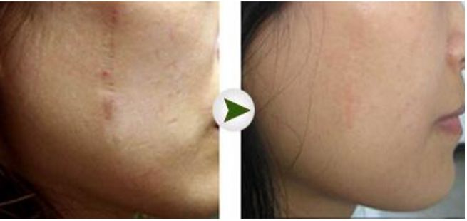 成都眼部修復排名前三的醫(yī)生——劉輔容、李競、盧尚兵等