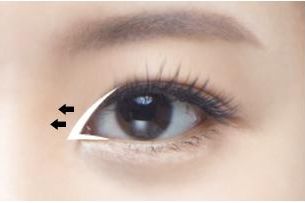 禪城區(qū)中心醫(yī)院整形科成功改變徐威強下頜角，告別「方姐」稱號！