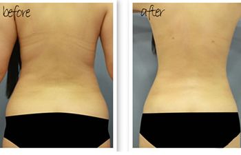 北京哪位醫(yī)生在八大處進(jìn)行隆胸手術(shù)較為專業(yè)？