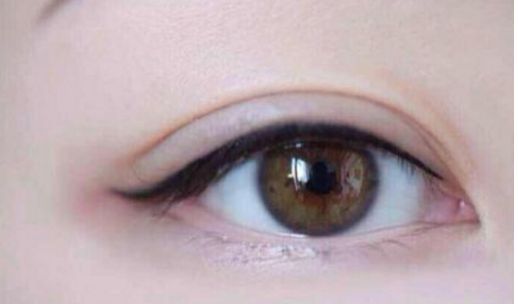 體驗太平整形醫(yī)院？尋覓醫(yī)術(shù)高手盛裝案例