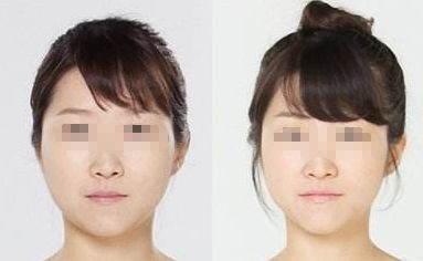 廣州哪家醫(yī)院能夠有效除皺？詳細介紹醫(yī)院基本情況分享