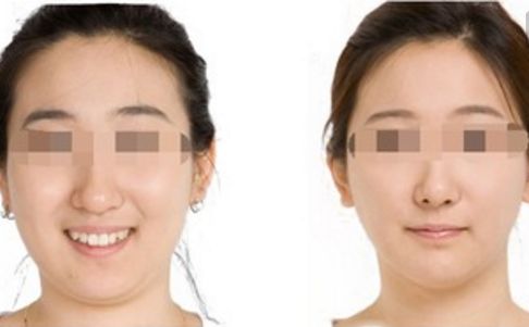 鄭州哪位醫(yī)生在鼻整形領域赫赫有名？口碑出類拔萃的五位專家揭曉！