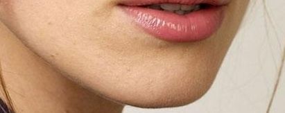 2023年北京大腿脂肪醫(yī)院排名對(duì)比，醫(yī)療技術(shù)強(qiáng)勁競(jìng)爭(zhēng)