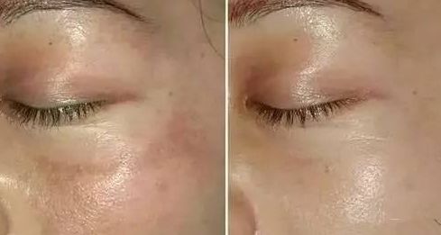 常州市第一人民醫(yī)院整形燒傷科：找對(duì)醫(yī)生，就對(duì)了！