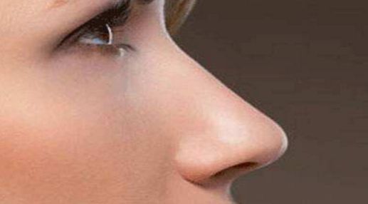 雙眼皮修復(fù)失敗后的最佳時機是什么時候？