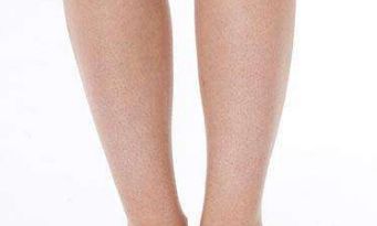 北京聯(lián)合麗格王巖醫(yī)生雙眼皮療效大揭秘，令人驚艷的成功案例浮出水面