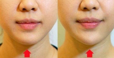 安徽乳房修復整形醫(yī)院哪家靠譜？公立三甲推薦！專家團隊值得信賴