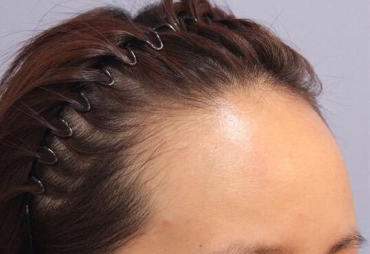 哈爾濱羽禪醫(yī)美，哪些熱門項目受歡迎？