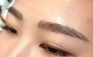 北京五家太陽穴整形醫(yī)院，排名榜揭曉！手術(shù)前必知攻略，高能提醒！