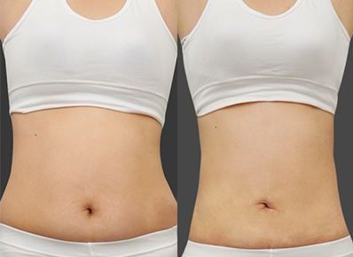 智慧選擇，打造肌膚零瑕疵！廣東祛斑醫(yī)院大比拼，真實實力PK！