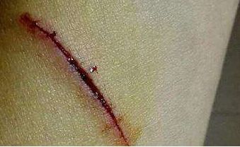 北京祛斑兩全皆美，這些醫(yī)院實(shí)力收割好評！