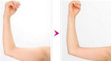 揭曉廣州五大翹楚!不容錯(cuò)過的豐胸醫(yī)院大盤點(diǎn)