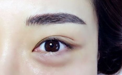 重慶杰出眼科專家范文亮醫(yī)生：醫(yī)術(shù)高超，多個(gè)成功案例揭秘