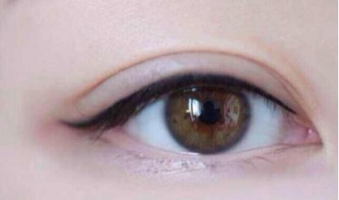 南寧愛思特吸脂效果好嗎？有哪些值得注意的地方？