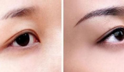 新一期海南隆鼻醫(yī)院名單來啦！維多利亞實(shí)力引領(lǐng)口碑榜！