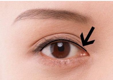 南京胸部整形醫(yī)生吳國(guó)平的最新成功案例！