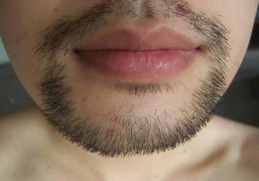 哪些醫(yī)院是滄州祛疤的好選擇？你知道嗎？