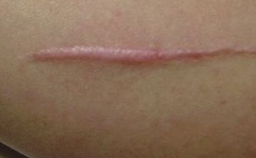 成都比較受推薦的磨骨醫(yī)生排行榜：前十強名單公布！