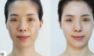 常州治療眼袋口碑好的公立醫(yī)院有哪些？