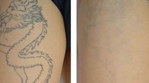 2023年鄭州整形醫(yī)院最新推薦！天后、華領(lǐng)、美萊等全面介紹！