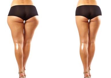 國內(nèi)去疤痕醫(yī)院匯總~領(lǐng)先技術(shù)助力去除疤痕與胎記