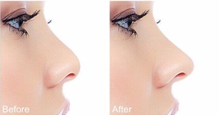 廣西愛(ài)思特劉曉軍耳再生費(fèi)用、技術(shù)詳解！優(yōu)勢(shì)特點(diǎn)一覽！