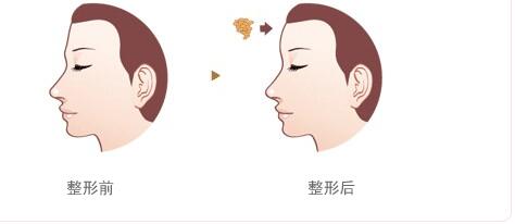 綿陽碧蓮盛植發(fā)醫(yī)院的效果如何？如何查詢地址及醫(yī)生信息？