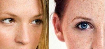 北京大學深圳醫(yī)院鼻子整形科2023近期成果展示