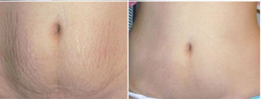 多位知名醫(yī)生修復(fù)雙眼皮技術(shù)對比，王太玲和盧建建誰更出眾？立體醫(yī)學(xué)美容室推薦名醫(yī)修復(fù)雙眼皮解析及價格大