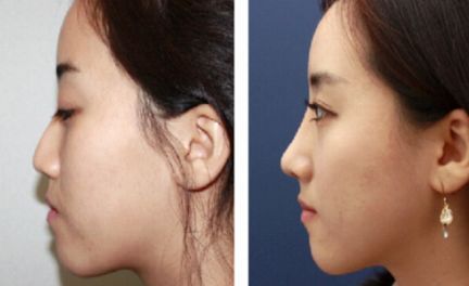 廈門整形醫(yī)院綜合評(píng)比，首屈一指的醫(yī)療機(jī)構(gòu)引領(lǐng)行業(yè)潮流