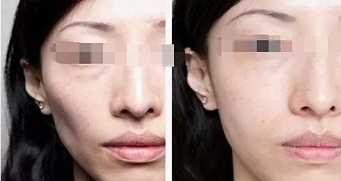 廈門整容醫(yī)院實力排名揭曉，輕松擁有美麗容顏！