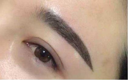 上海哪家醫(yī)院值得推薦進(jìn)行激光祛老年斑？