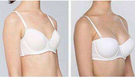 杭州美萊高士乾醫(yī)生的優(yōu)秀技能展示及下頜整形手術(shù)成功案例分享