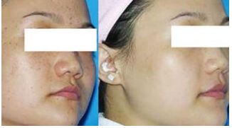 成都圣丹福賀忠波隆胸術(shù)實踐回顧，驚人成效曝光！