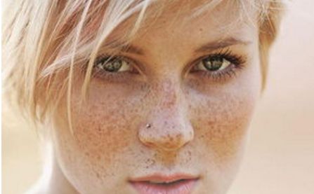 青州人民醫(yī)院美容科，了解一下主任介紹丨2023價格表丨激光祛痘案例排行