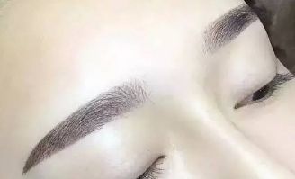 杜園園2023年雙眼皮修復(fù)案例揭秘，浦東區(qū)獨(dú)家經(jīng)驗(yàn)分享